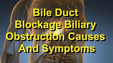 Bile Duct Obstruction: Symptoms, Causes & Treatment